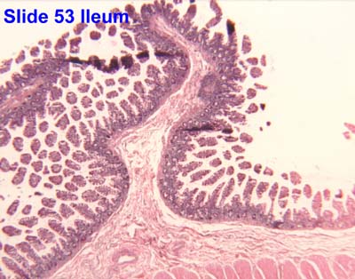 Lower GI not the stomach diagram labeled 